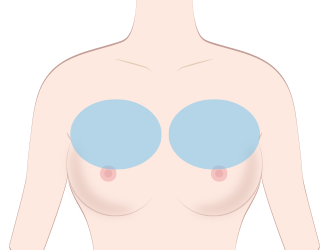 胸の上部にハリを出す